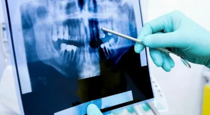 Диагностика стоматологических заболеваний