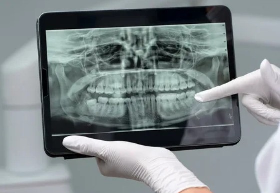 Диагностика зубов