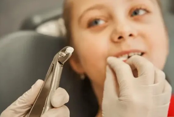 Удаление молочных зубов